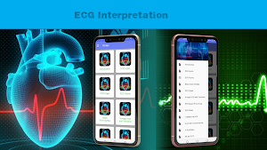 ECG A to Z Interpretation Guide screenshot 2
