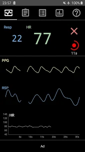 Heart Rate Monitor - HRV & RSP