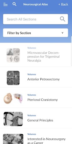 The Neurosurgical Atlasのおすすめ画像3