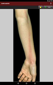 Captura 20 Fitzpatrick's Dermatology Flas android