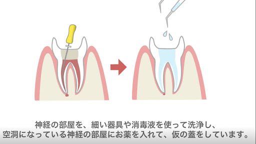 Dental-Exp-C Screen 2