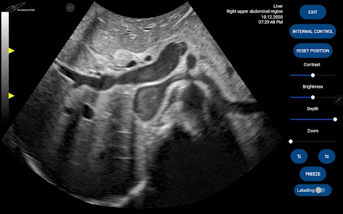 Scanbooster Ultrasound Sim Screenshot