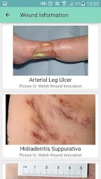 Wound Education App