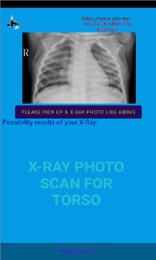 XRay Scan Torso